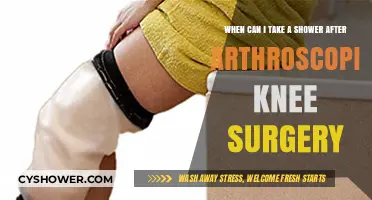 Post-Arthroscopic Knee Surgery Shower Guidelines: Timing and Tips for Recovery