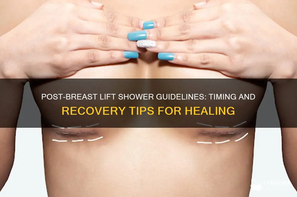when can i take a shower after breast lift