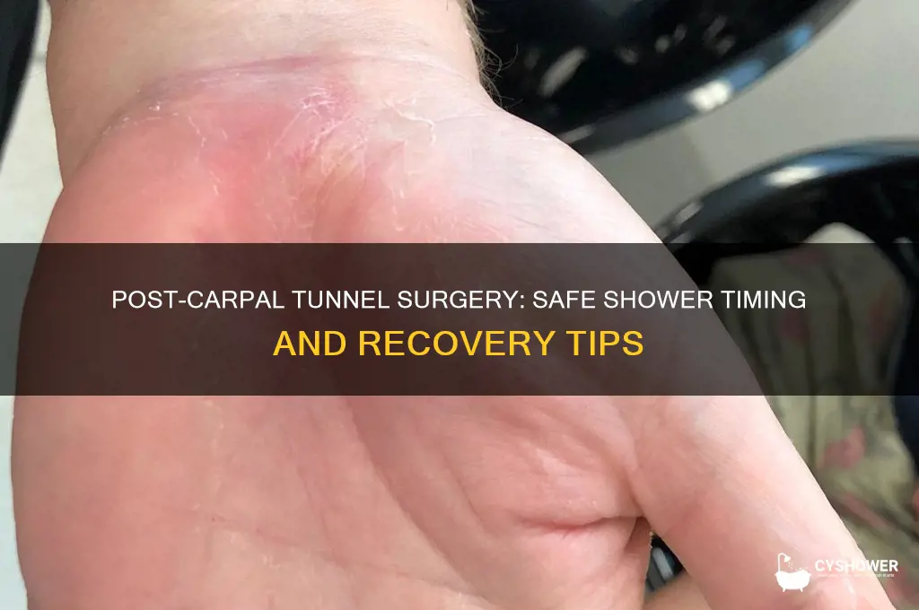 when can i take a shower after carpal tunnel surgery