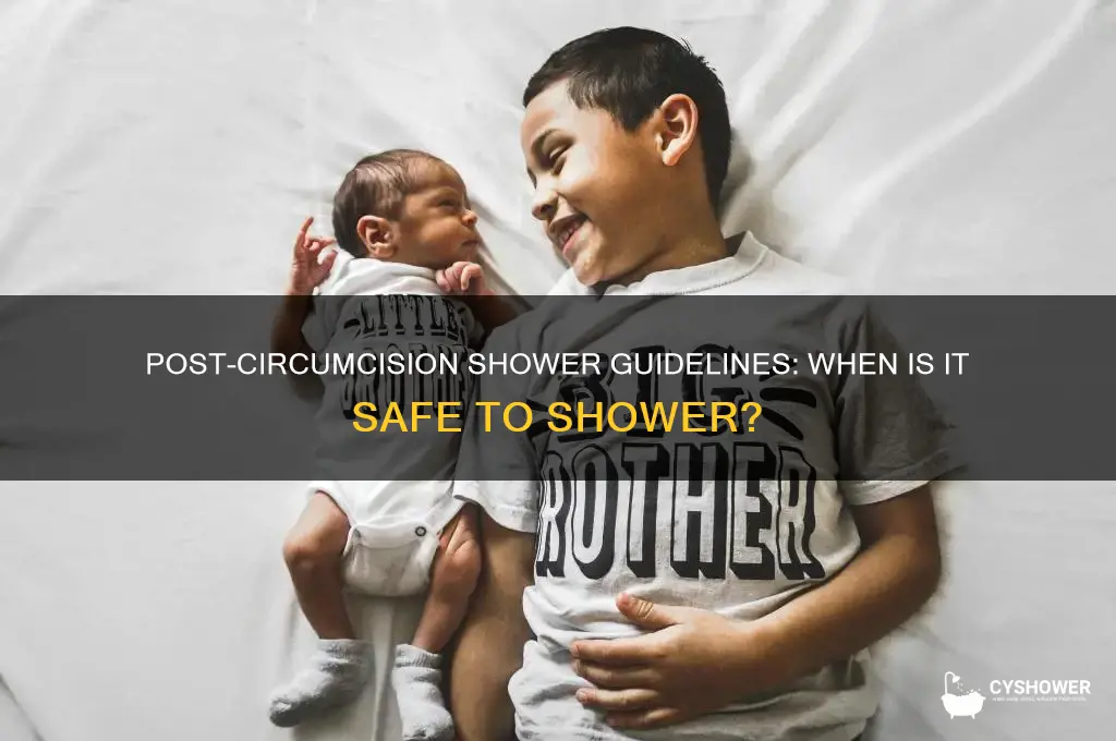 when can i take a shower after circumcision