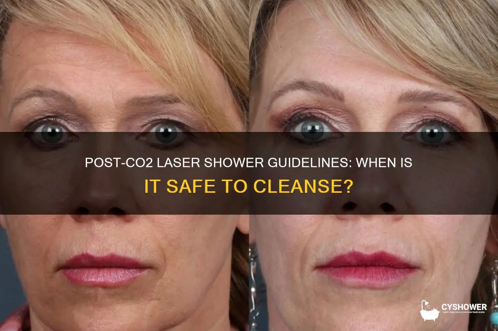 when can i take a shower after co2 laser