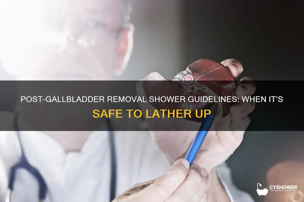 when can i take a shower after gallbladder removal