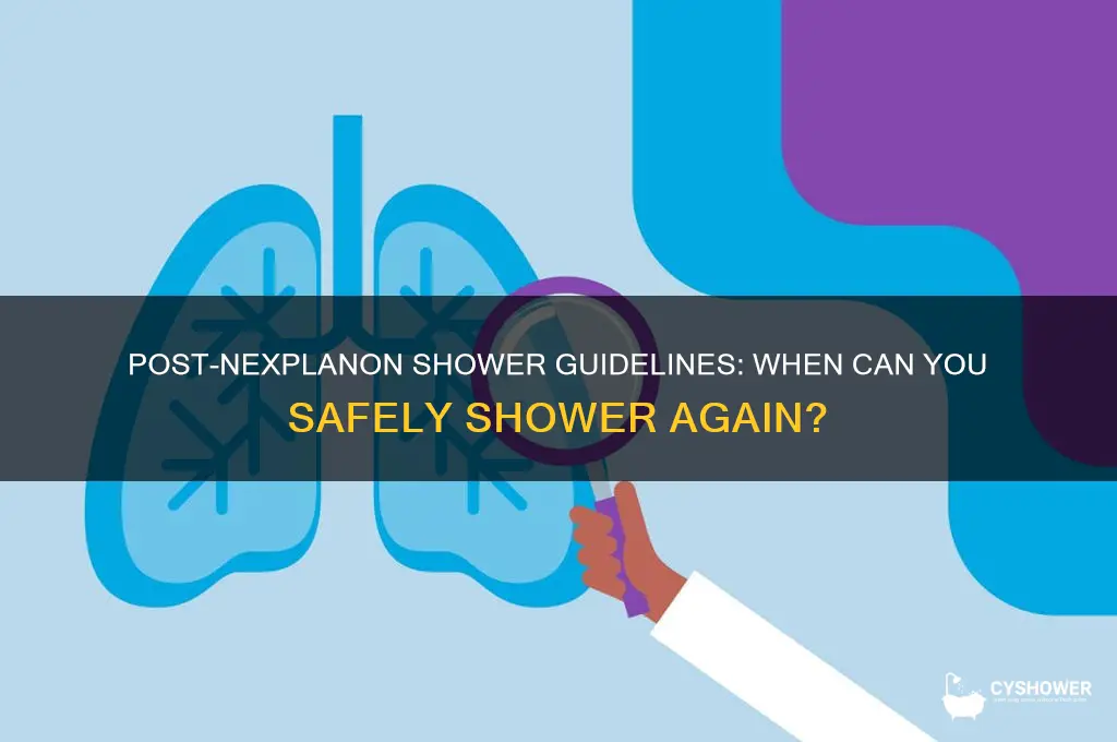 when can i take a shower after getting nexplanon