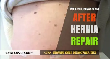 Post-Hernia Repair Shower Guidelines: When It’s Safe to Get Wet