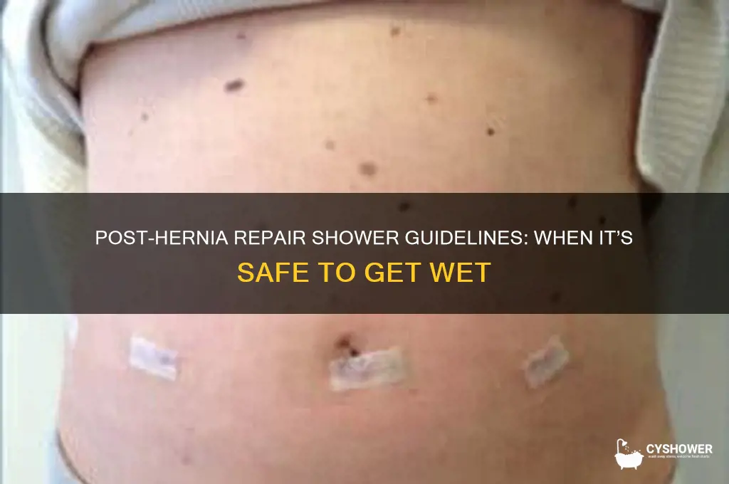 when can i take a shower after hernia repair