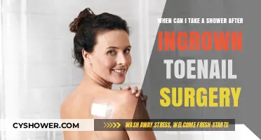 Post-Ingrown Toenail Surgery Shower Guide: Timing and Tips for Healing