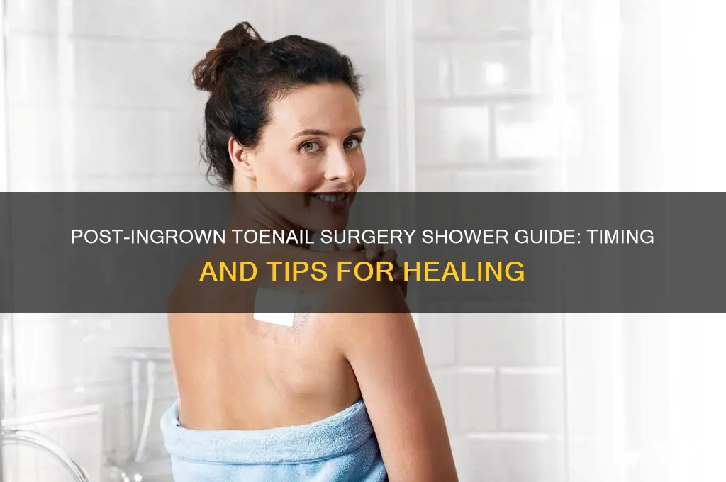 when can i take a shower after ingrown toenail surgery