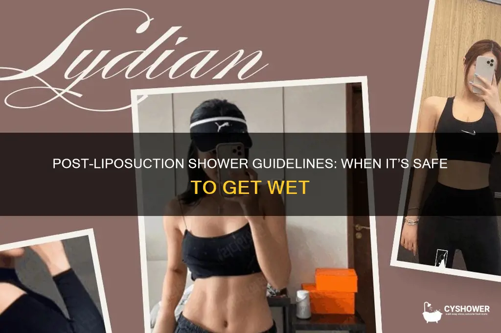 when can i take a shower after liposuction