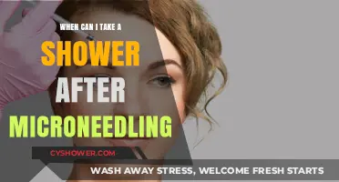 Post-Microneedling Shower Guide: When It’s Safe to Cleanse Your Skin