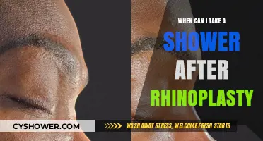 Post-Rhinoplasty Shower Guidelines: When It’s Safe to Get Wet