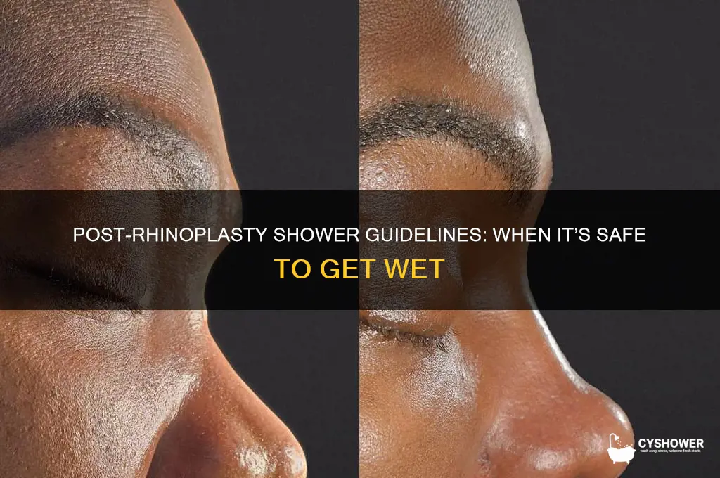when can i take a shower after rhinoplasty