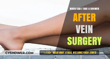 Post-Vein Surgery Shower Guidelines: When It’s Safe to Lather Up