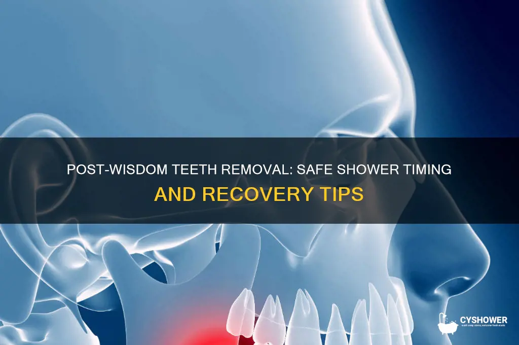 when can i take a shower after wisdom teeth removal