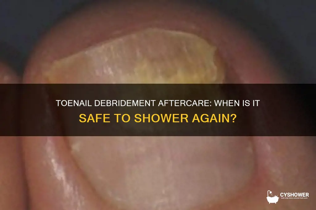 when can i take shower after toenail debridement