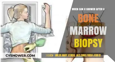 Bone Marrow Biopsy Recovery: When Can You Shower Safely?