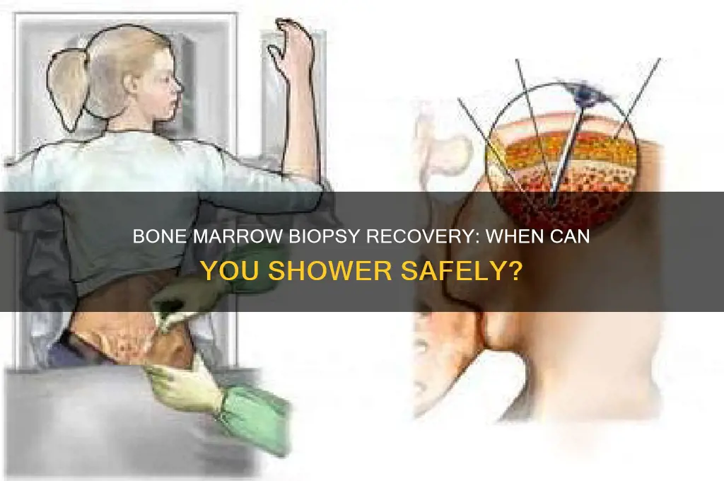 when can u shower after a bone marrow biopsy