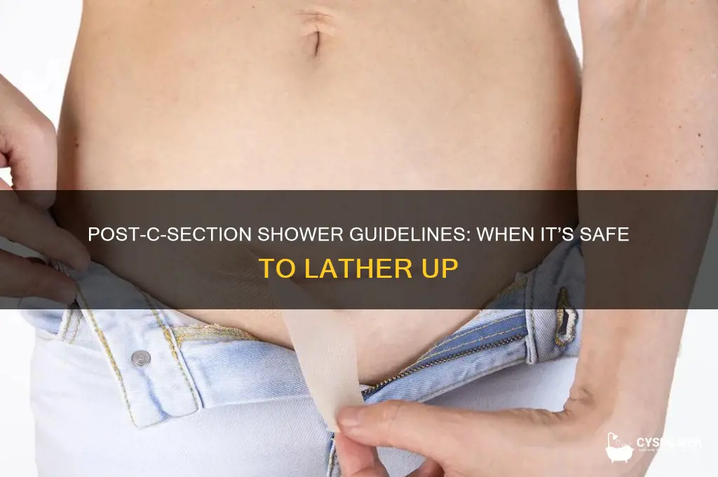 when can you shower after a csection