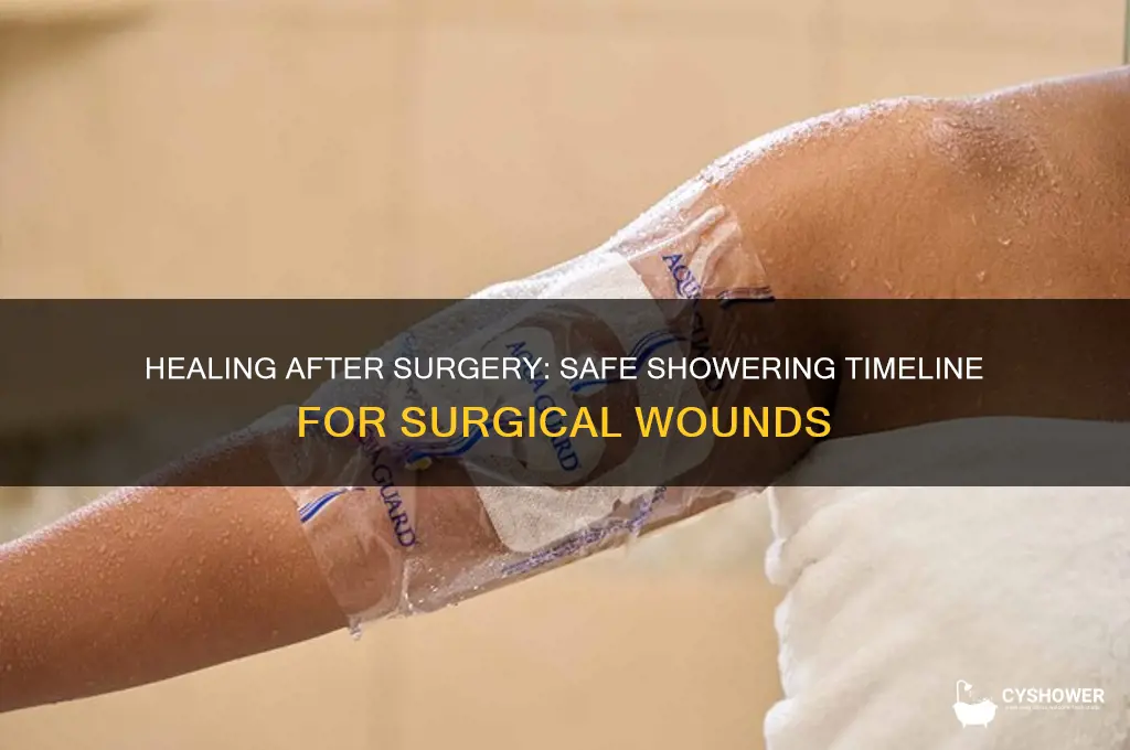 when can you shower after a surgical wound