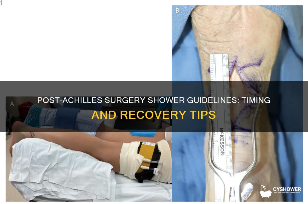 when can you shower after achilles surgery