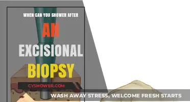 Post-Excisional Biopsy Shower Guidelines: When It’s Safe to Cleanse