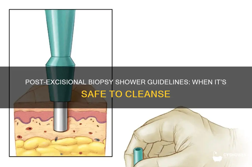 when can you shower after an excisional biopsy