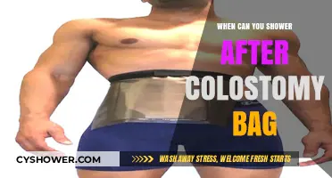 Post-Colostomy Shower Guide: When It’s Safe to Cleanse Again
