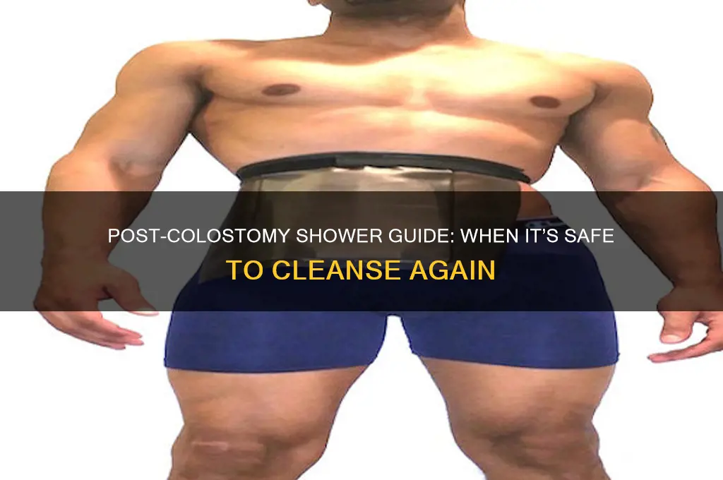 when can you shower after colostomy bag
