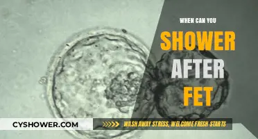 Post-FET Shower Guidelines: When Can You Safely Shower Again?