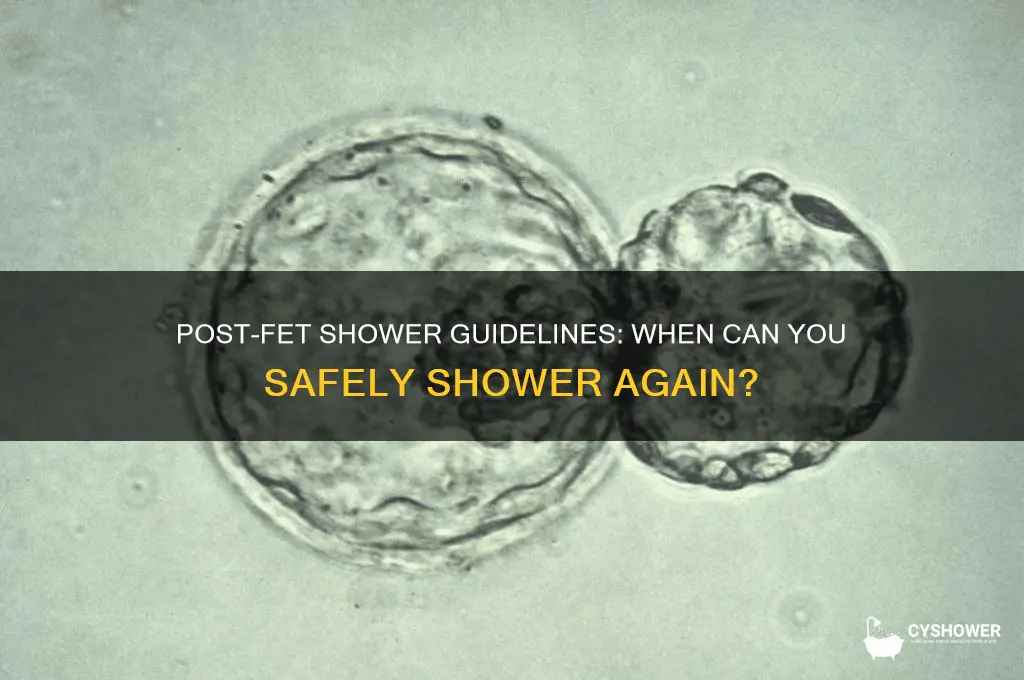 when can you shower after fet