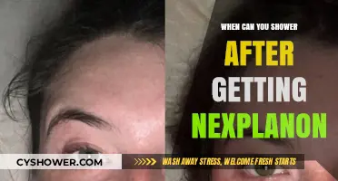 Showering After Nexplanon: Timing and Tips for Safe Recovery