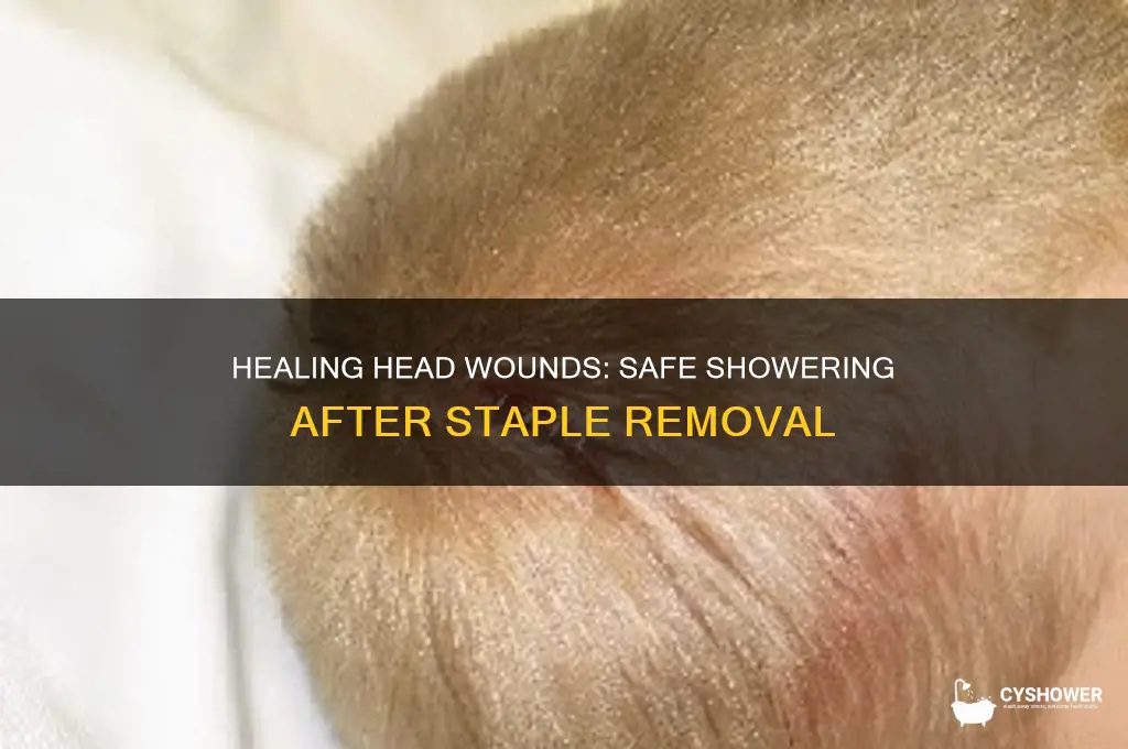 when can you shower after getting staples in your head