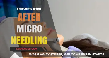 Post-Microneedling Shower Guide: Timing and Tips for Safe Healing