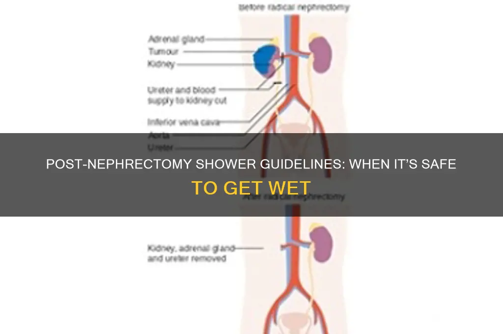 when can you shower after nephrectomy