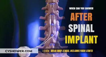 Post-Spinal Implant Shower Guidelines: Timing and Safety Tips