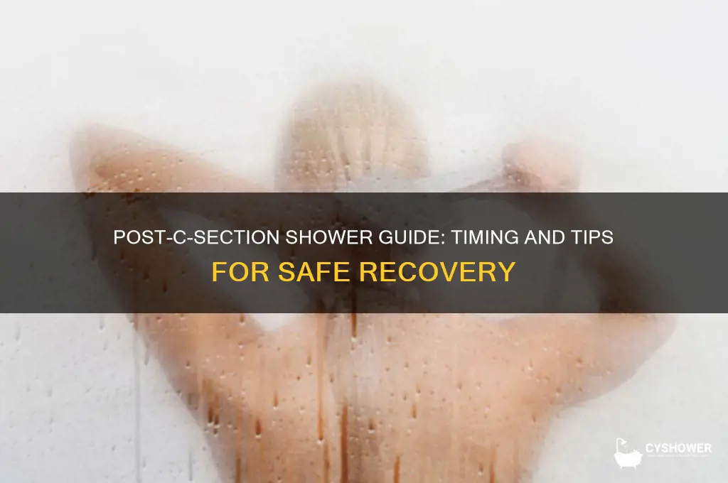 when can you take a shower after c section