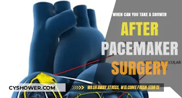 Pacemaker Surgery Recovery: Safe Shower Timing and Post-Op Care Tips