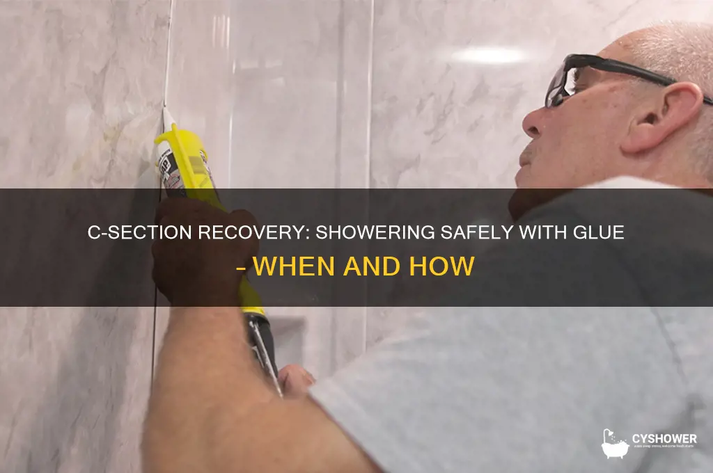 when can you take shower c section with glue