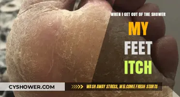 Post-Shower Itchy Feet: Causes, Remedies, and Prevention Tips