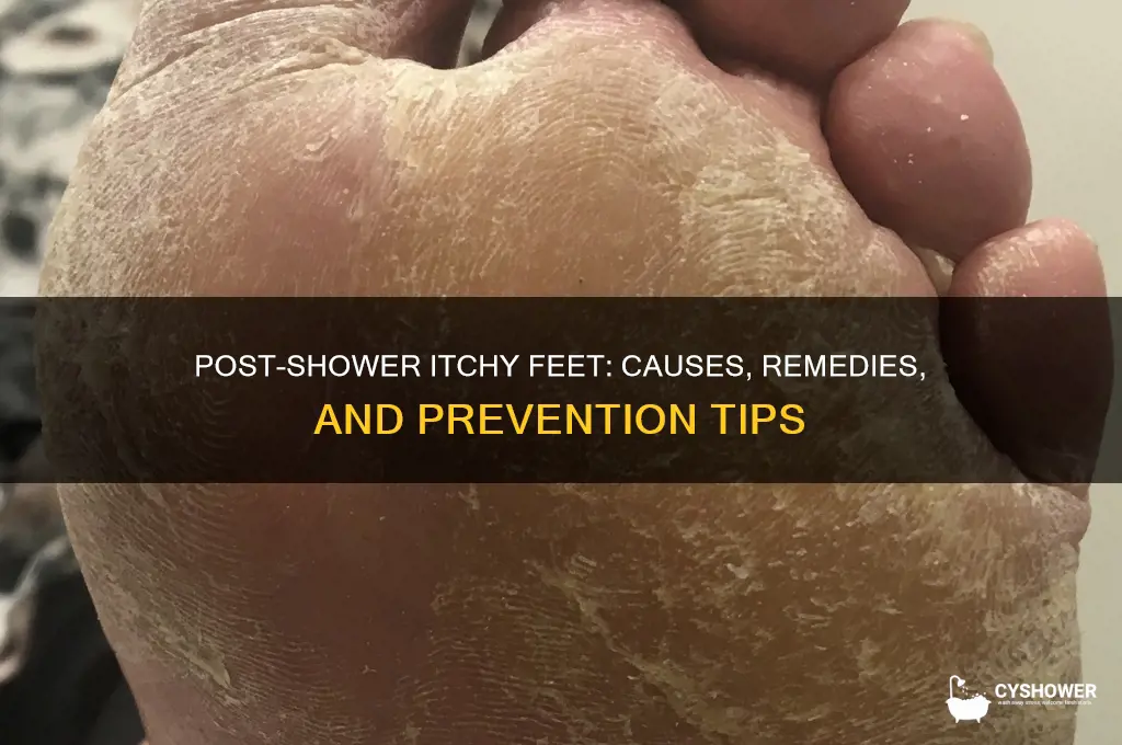 when i get out of the shower my feet itch