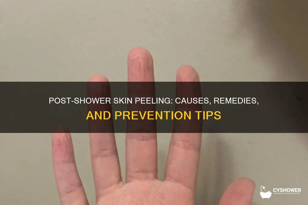 when i get out of the shower my skin peels