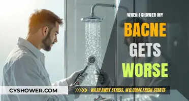Why Showering Might Worsen Your Bacne: Causes and Solutions