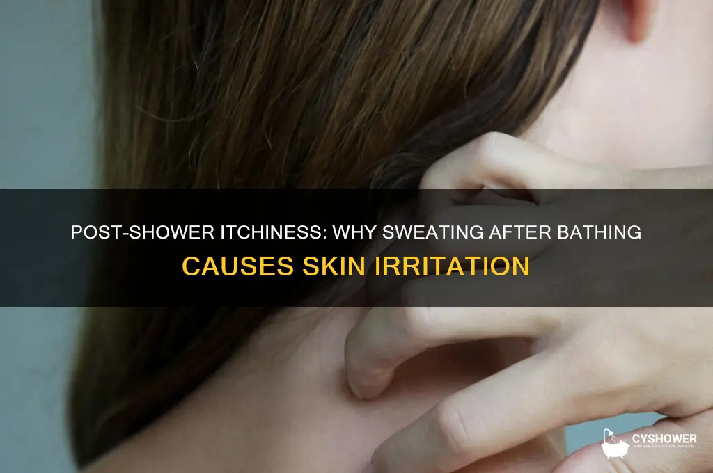when i sweat after a shower i get itchy