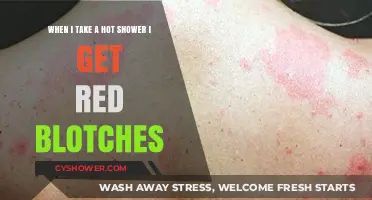 Hot Showers Causing Red Blotches? Understanding Skin Reactions and Remedies