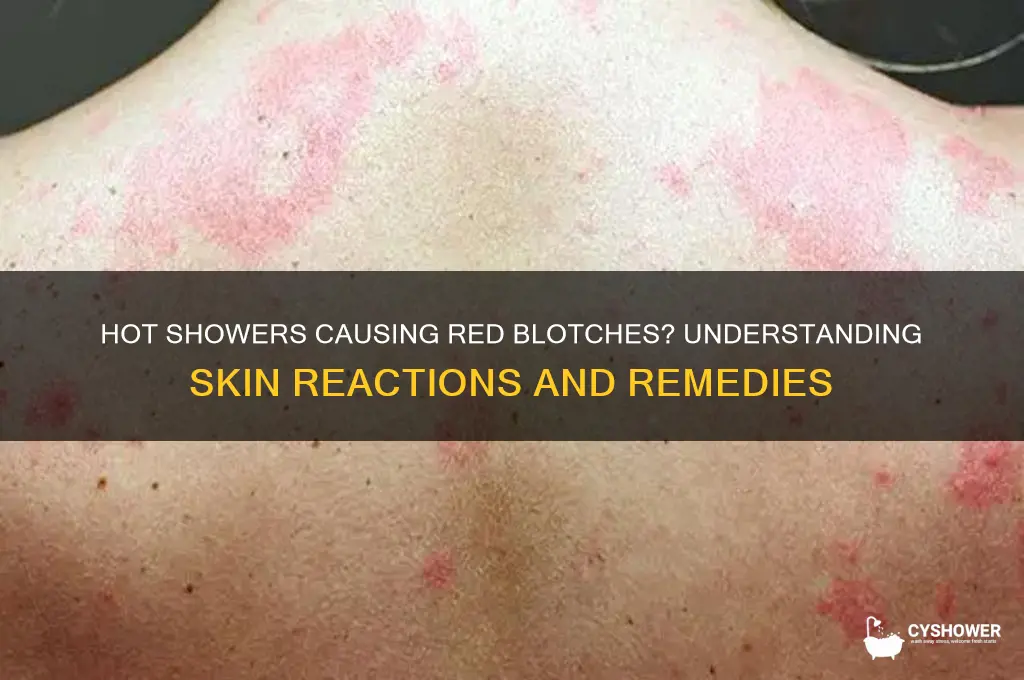 when i take a hot shower i get red blotches