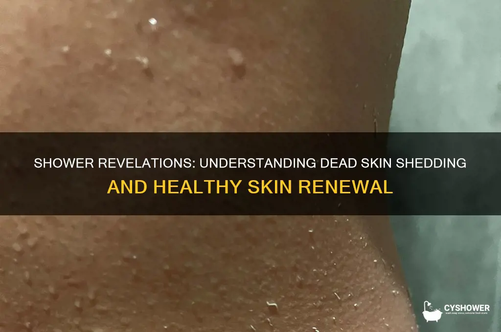 when i take a shower i see dead skin