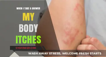 Why Does My Skin Itch During Showers? Causes and Solutions