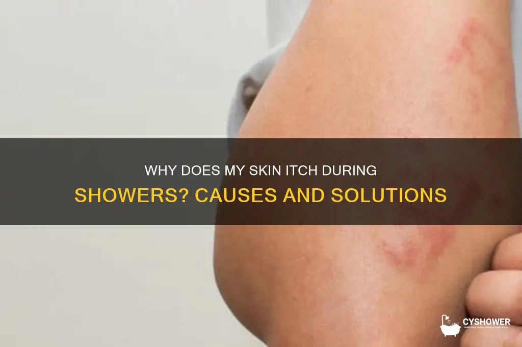when i take a shower my body itches