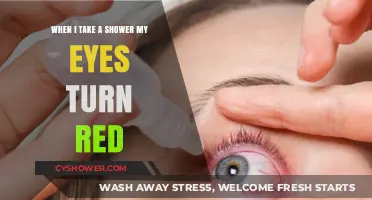Why Do My Eyes Turn Red After Showering? Causes and Solutions