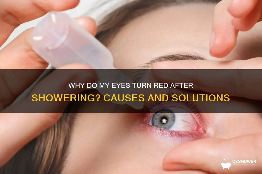 when i take a shower my eyes turn red