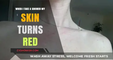 Why Does My Skin Turn Red After Showering? Causes and Solutions